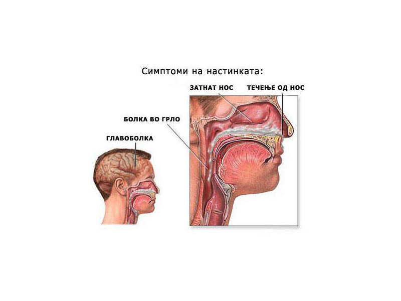 НАСТИНКА – НАЗОФАРИНГИТ